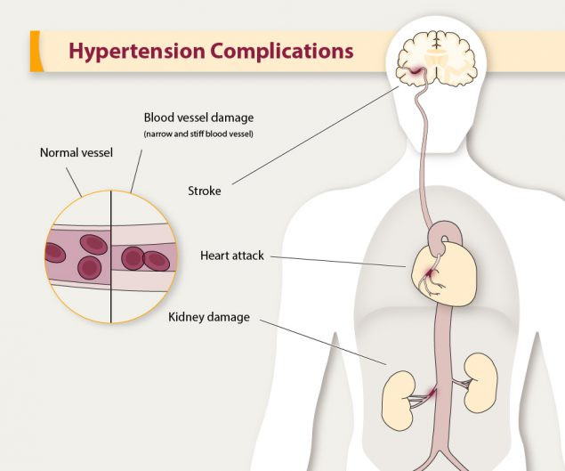 do-i-have-hypertension-understanding-high-blood-pressure